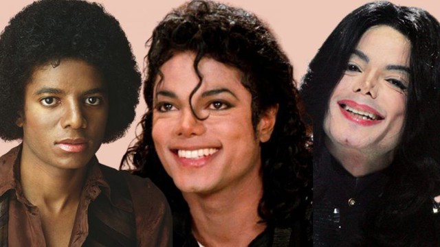 Sự thật về căn bệnh hiếm khiến Michael Jackson phải tẩy trắng da- Ảnh 1.