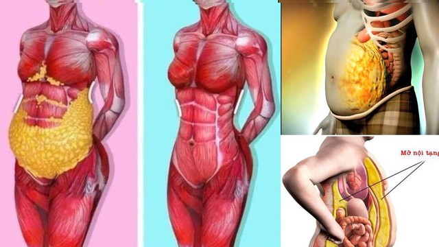 Mỡ nội tạng là một trong những yếu tố nguy hiểm đối với sức khỏe nhưng thường bị nhiều người bỏ qua.
