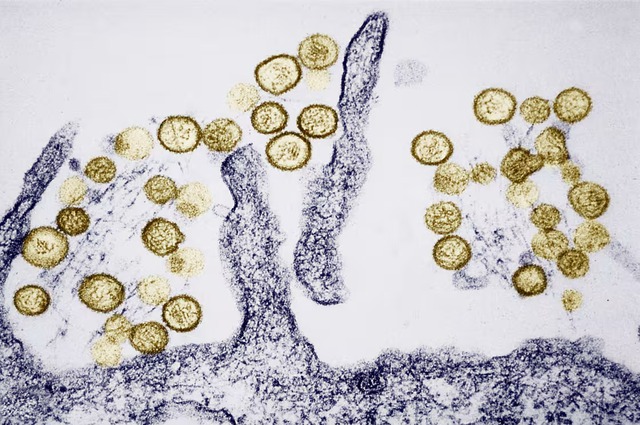 Hantavirus khiến 3 người trên du thuyền MV Hondius tử vong nguy hiểm ra sao?- Ảnh 2.