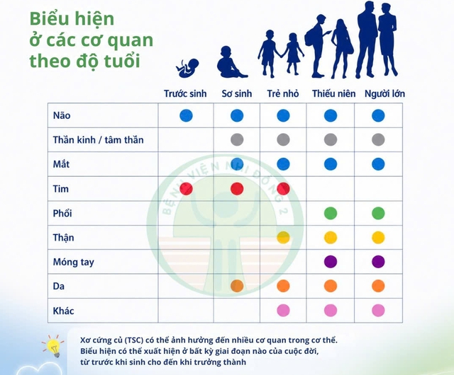 Trẻ sơ sinh mắc hội chứng di truyền hiếm gặp- Ảnh 2.