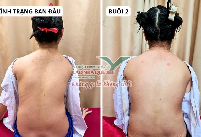 Tìm hiểu nguyên lý 'Khai thông cột sống' của Lão Nhà Quê- Ảnh 2. Tìm hiểu nguyên lý 'Khai thông cột sống' của Lão Nhà Quê- Ảnh 2.