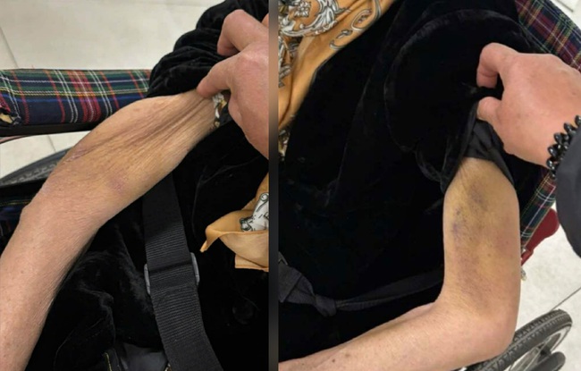 Nỗi ân hận của gia đình cụ bà ngồi xe lăn nghi bị giúp việc bạo hành- Ảnh 2.