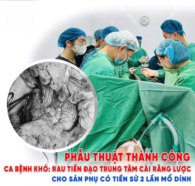 Cứu sản phụ mang thai lần 3 mắc rau tiền đạo trung tâm cài răng lược- Ảnh 1. Cứu sản phụ mang thai lần 3 mắc rau tiền đạo trung tâm cài răng lược- Ảnh 1.