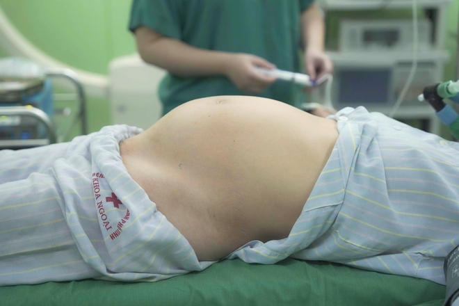 Phẫu thuật khối u nang buồng trứng nặng 6kg cho người phụ nữ 56 tuổi- Ảnh 4. Phẫu thuật khối u nang buồng trứng nặng 6kg cho người phụ nữ 56 tuổi- Ảnh 4.