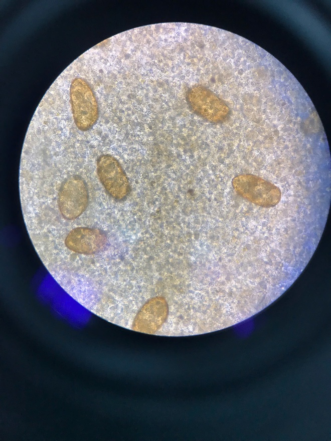 Bị nhiễm ký sinh trùng cần đi khám và điều trị ở đâu?- Ảnh 3.