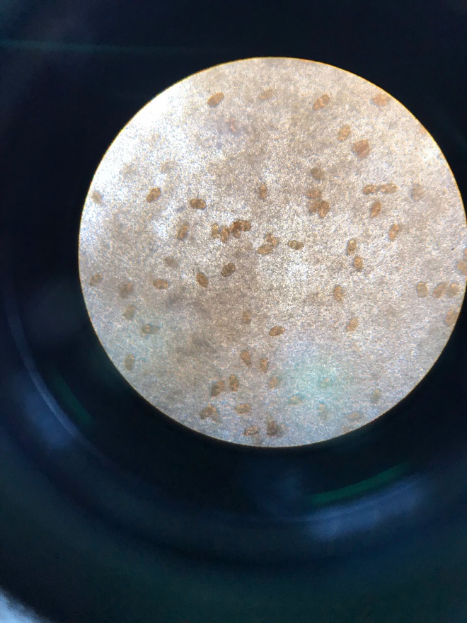 Bị nhiễm ký sinh trùng cần đi khám và điều trị ở đâu?- Ảnh 2.