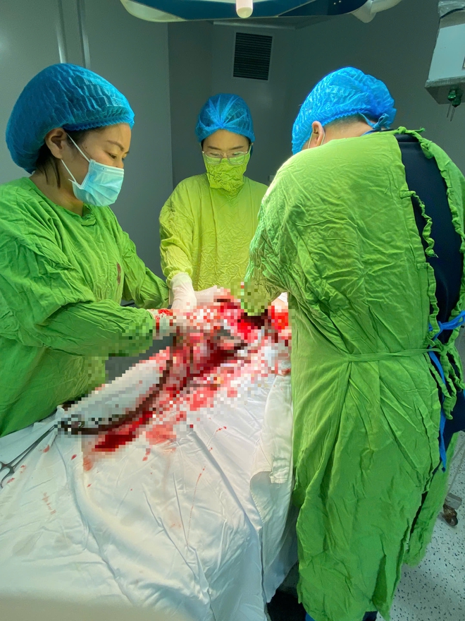 Phát hiện dây rốn bất thường, bác sĩ kịp thời mổ bắt con, cứu thai nhi thoát nguy hiểm- Ảnh 1. Phát hiện dây rốn bất thường, bác sĩ kịp thời mổ bắt con, cứu thai nhi thoát nguy hiểm- Ảnh 1.