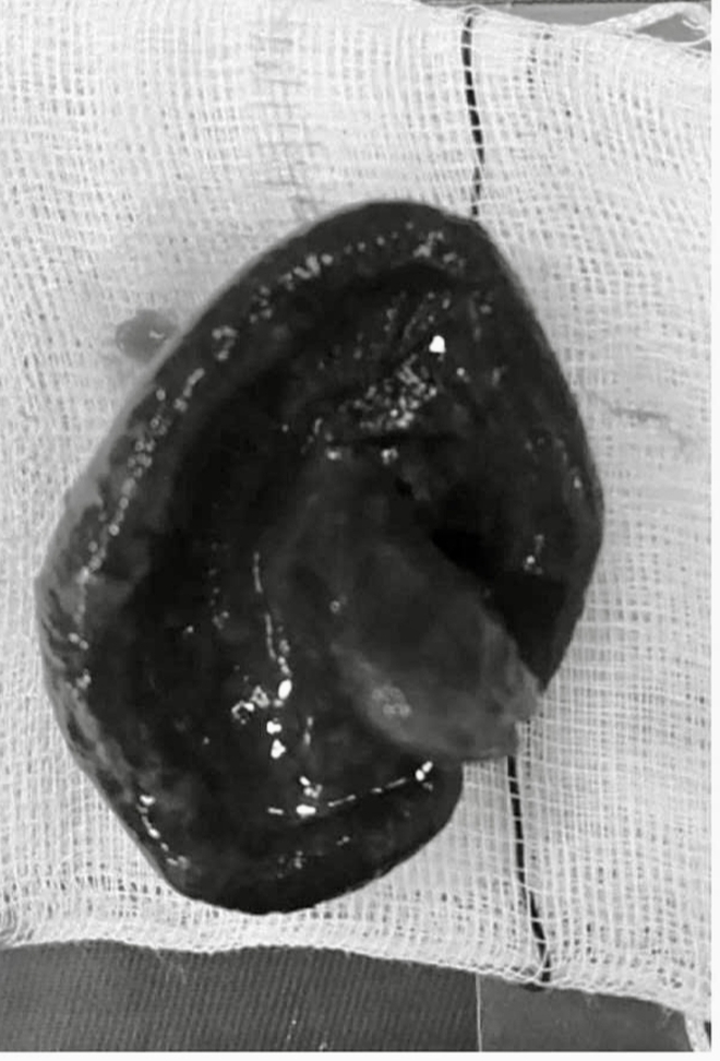 Liên tiếp ca mắc dị vật nguy hiểm, bác sĩ cảnh báo nguy cơ đe dọa tính mạng- Ảnh 5.