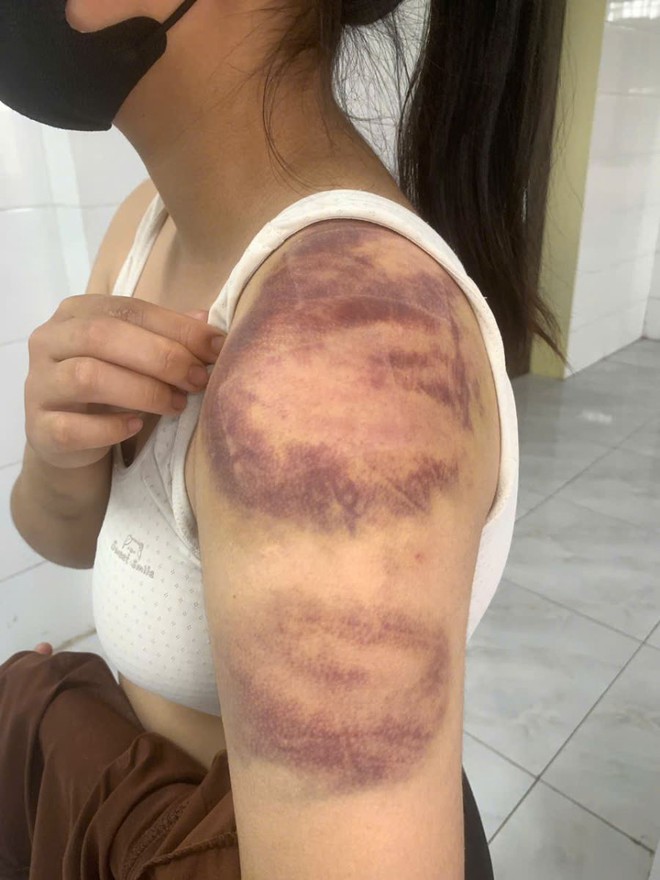 Tạm giữ người đàn ông nhiều lần đánh đập con gái và vợ đang mang thai- Ảnh 1.