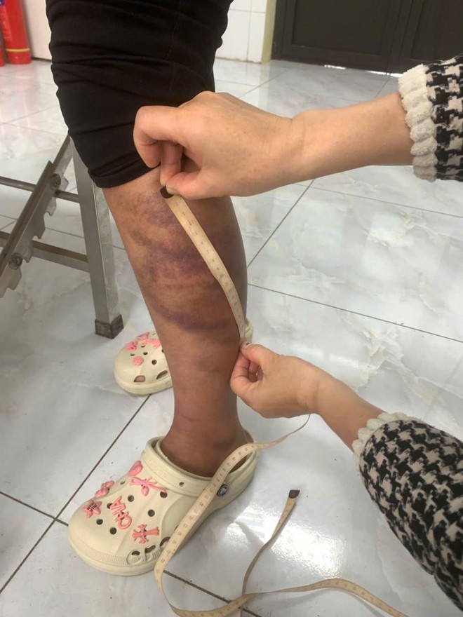 Tạm giữ người đàn ông nhiều lần đánh đập con gái và vợ đang mang thai- Ảnh 2.