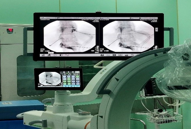 Bệnh viện ĐK TP Vinh triển khai Đơn vị chống đau - Khám, điều trị chuyên sâu các bệnh lý đau mạn tính, đau do bệnh lý thần kinh, cột sống, cơ xương khớp- Ảnh 1.