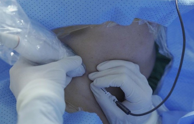 Bệnh viện ĐK TP Vinh triển khai Đơn vị chống đau - Khám, điều trị chuyên sâu các bệnh lý đau mạn tính, đau do bệnh lý thần kinh, cột sống, cơ xương khớp- Ảnh 4.