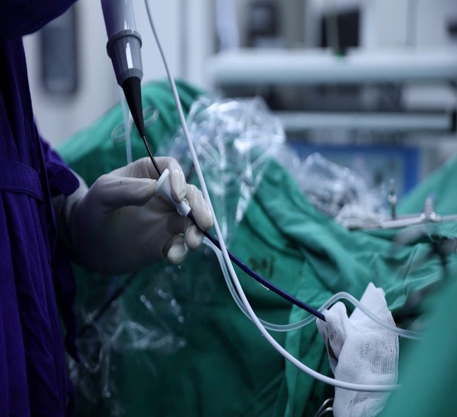 Cách tán sỏi thận không sẹo mổ- Ảnh 3.