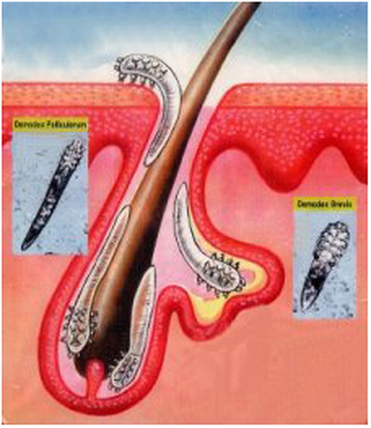  	Demodex ký sinh trên da và nang lông.