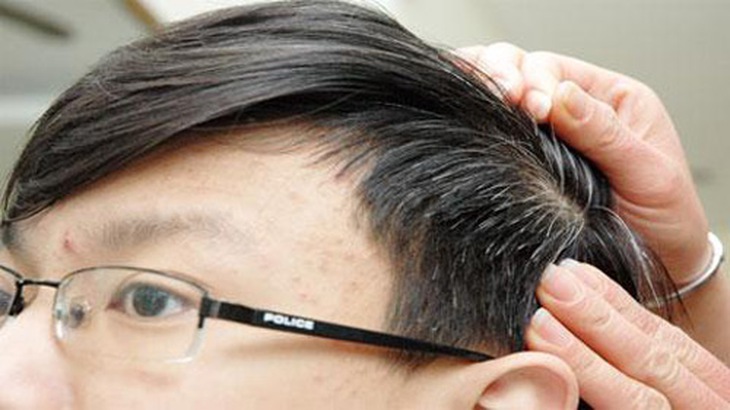 Món ăn - bài thuốc chữa chứng tóc bạc sớm - 1