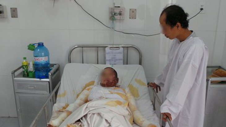 Sản phụ bị bỏng nặng đang được chăm sóc tích cực tại Chợ Rẫy