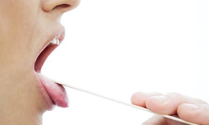 lưỡi, đoán bệnh, dấu hiệu, bệnh giang mai, cảm lạnh
