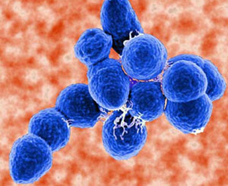 Phế cầu khuẩn treptococcus pneumoniae