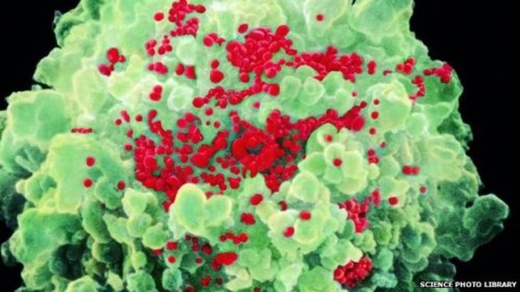 Nguy cơ lây nhiễm HIV trong quan hệ đồng tính nữ là rất hiếm nhưng không thể loại trừ hoàn toàn rủi ro. Ảnh: BBC