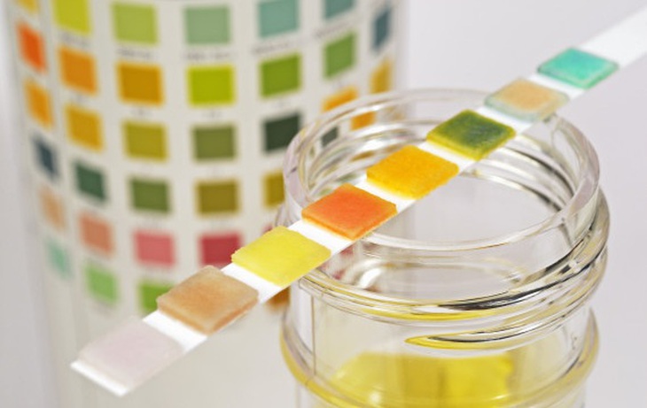 o-URINE-TEST-570-2183-1418135164.jpg