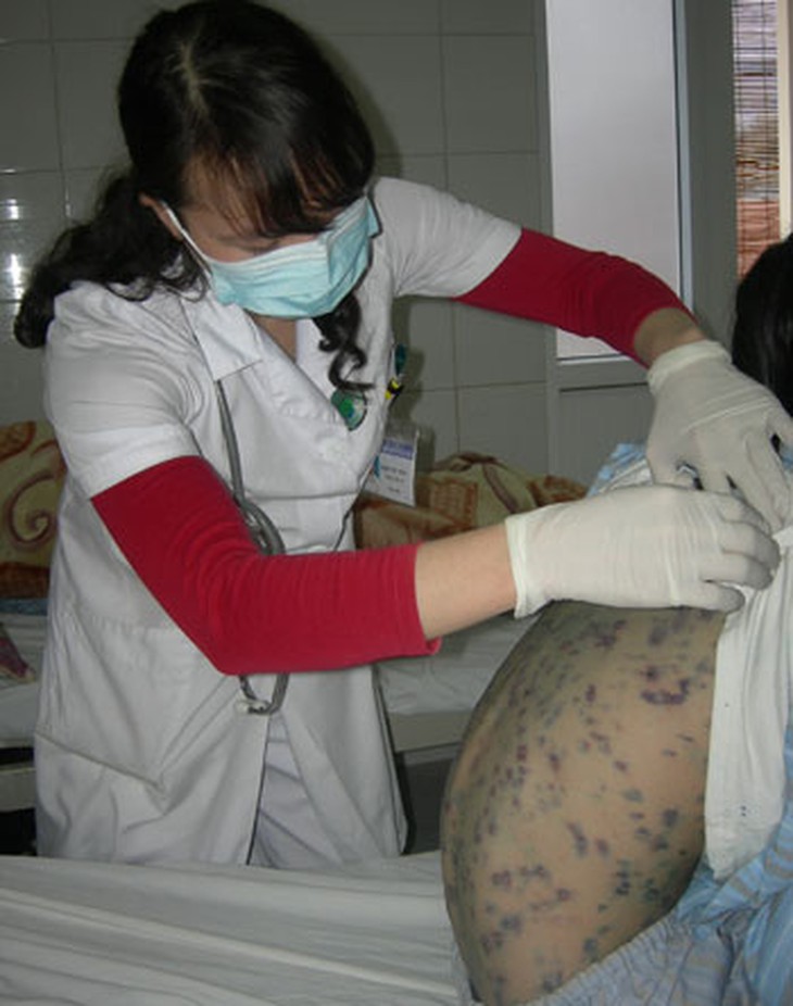 thuydau1.jpg
