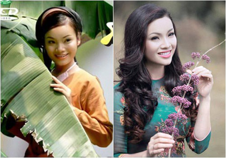 Sao thay đổi số mệnh nhờ nâng mũi? - 2