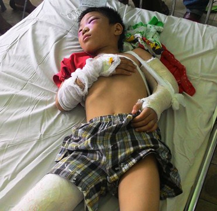 Kẻ đánh bé 6 tuổi gãy chân tay khai gì với công an?