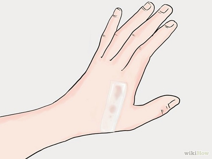 Lấy băng dính băng lên vùng bị sâu róm vương, để lấy nốt những sợi lông còn sót lại