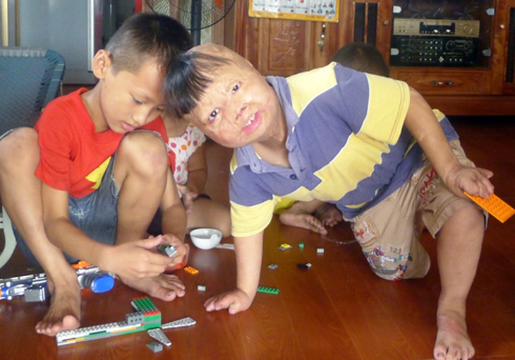 Năm nay Linh đã 6 tuổi và cũng ham chơi như mọi đứa trẻ khác cùng trang lứa.