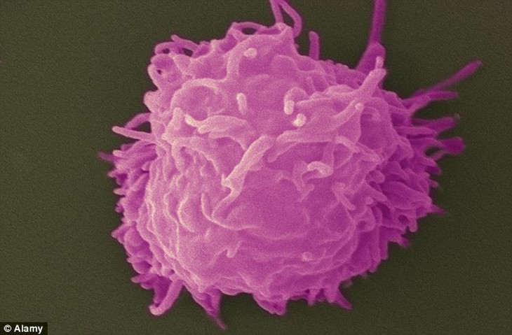 Ký sinh trùng acanthamoeba keratitis.