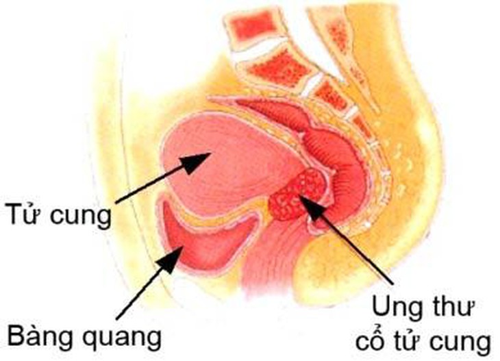 Ảnh minh họa. Nguồn ảnh: Y học cộng đồng