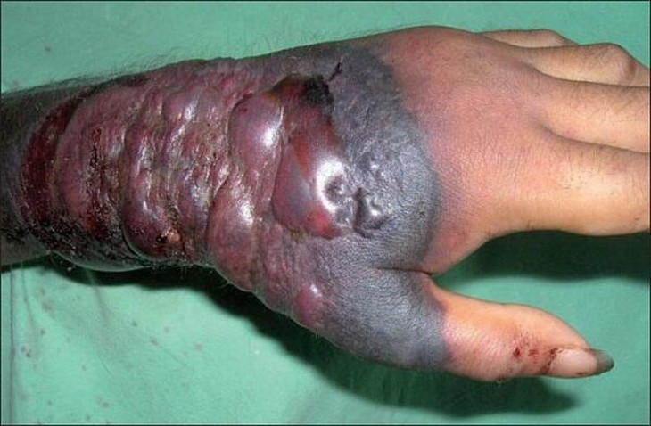 Rợn người hình ảnh chết chóc ở tâm đại dịch Ebola 6