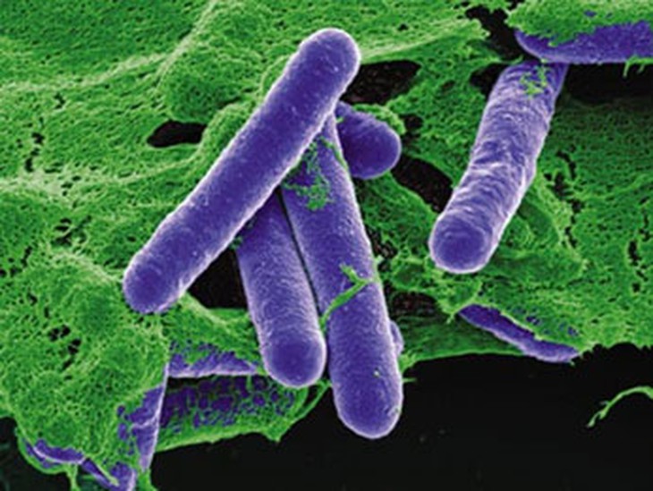 Vi khuẩn Clostridium botulinum.
