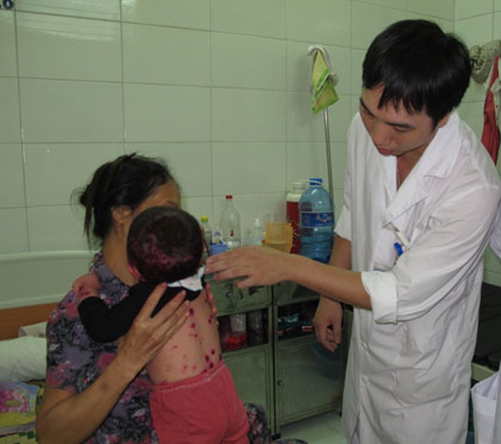 Thăm khám cho bệnh nhân bị thủy đậu tại BV Bệnh Nhiệt đới TW. Ảnh DT