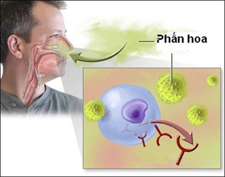 Phấn hoa từ không khí là một tác nhân gây dị ứng mùa xuân.