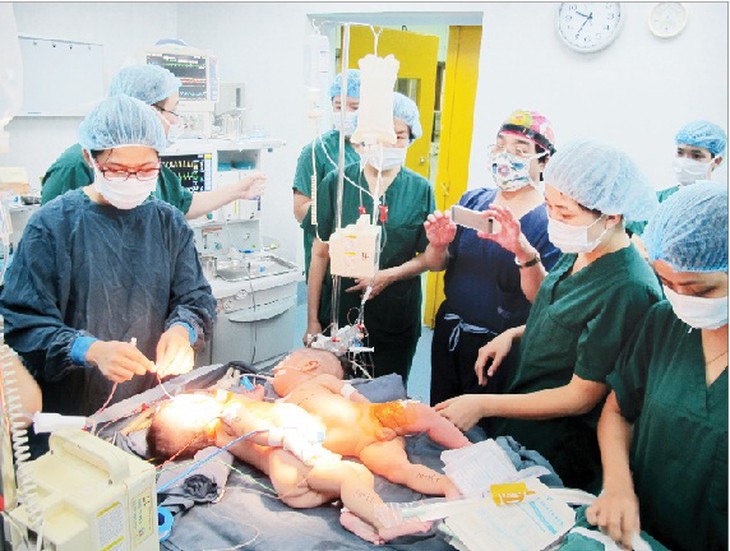 Các bác sĩ chuẩn bị ca phẫu thuật tách hai bệnh nhi.