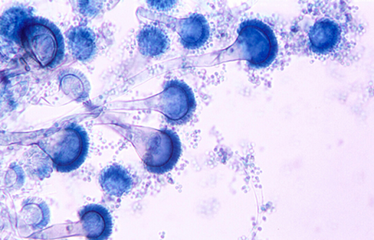 Nấm Aspergillus  fumigatus thường gây viêm xoang.