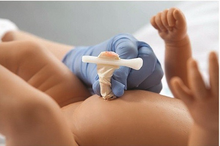 Chăm sóc vệ sinh da, rốn, mắt cho trẻ