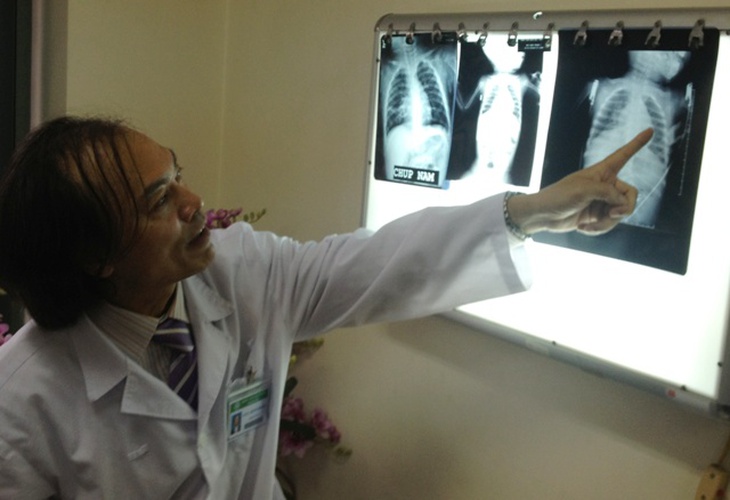 PGS.TS Nguyễn Tiến Dũng kiểm tra phim chụp X-quang cho bệnh nhi.