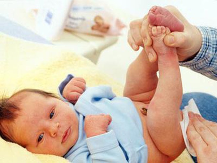 Cha mẹ cần chú ý vệ sinh cẩn thận cho bé.