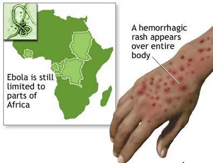 Ebola đang lan tràn tại một 