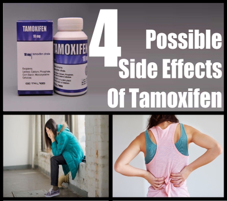 Các tác dụng phụ khi sử dụng tamoxifen như đau lưng, mệt mỏi, hoa mắt chóng mặt. 