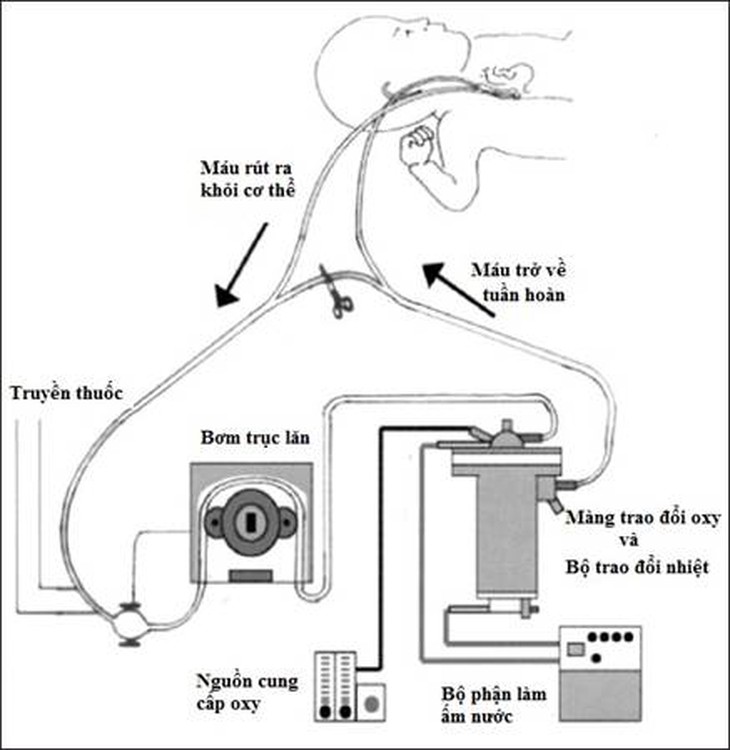 Nguyên lý hoạt động của kỹ thuật sử dụng màng trao đổi oxy ngoài cơ thể (ECMO).