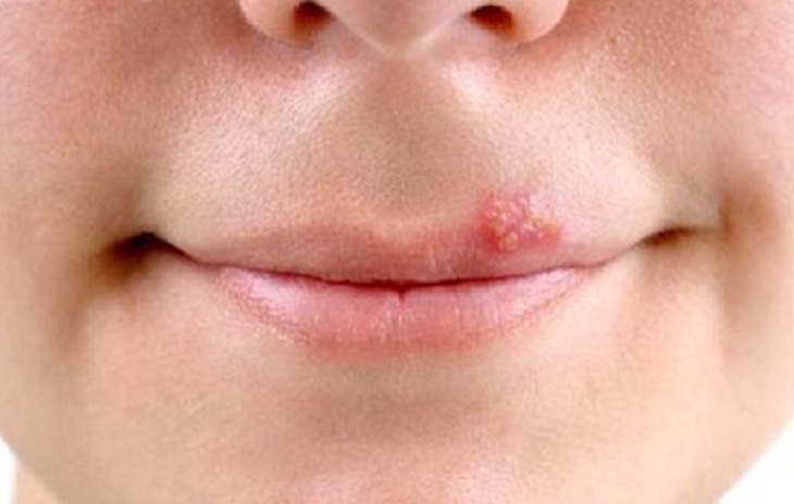 Tại sao chỉ vì một nụ hôn, trẻ có thể gặp tử thần?