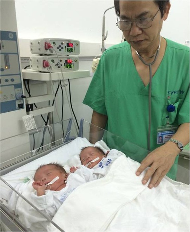 BS Lợi bên cặp song sinh đặc biệt nhất Việt Nam. Ảnh: BV cung cấp
