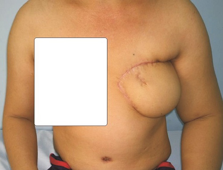 Bệnh nhân trước mổ.
