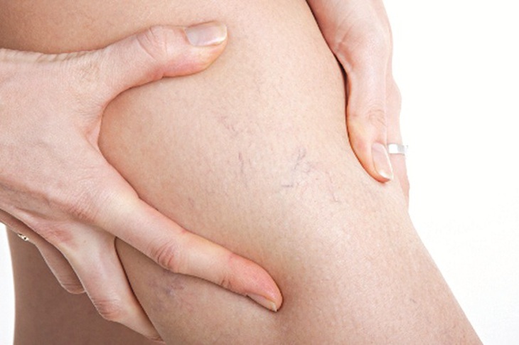 Có đến 20% lượng máu tăng thêm chảy qua các tĩnh mạch trong thai kỳ