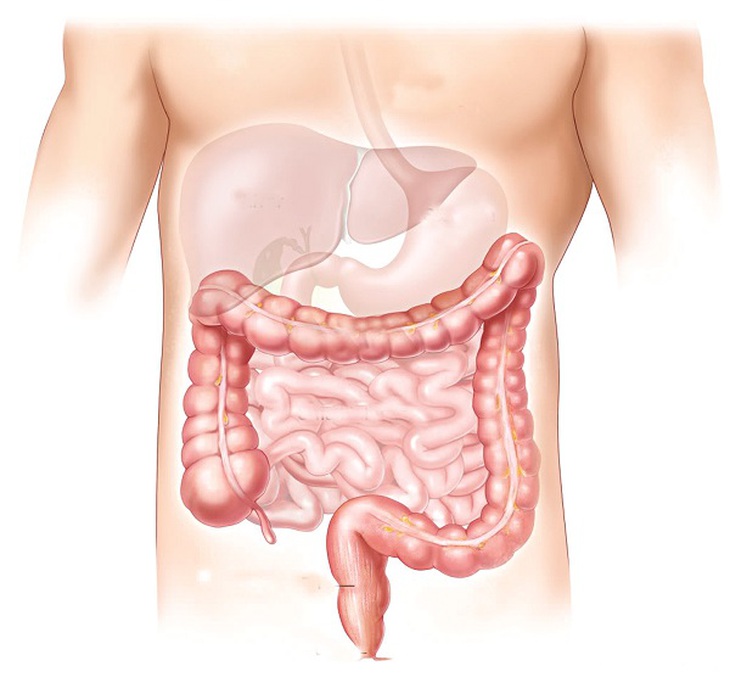Táo bón xảy ra khi phân di chuyển qua đường ruột chậm
