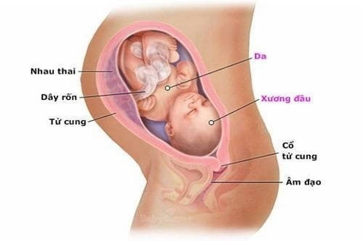 Những rắc rối nếu thai nhi không quay đầu - Ảnh 1. Những rắc rối nếu thai nhi không quay đầu - Ảnh 1.