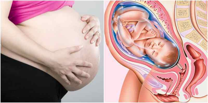 Những rắc rối nếu thai nhi không quay đầu - Ảnh 3. Những rắc rối nếu thai nhi không quay đầu - Ảnh 3.